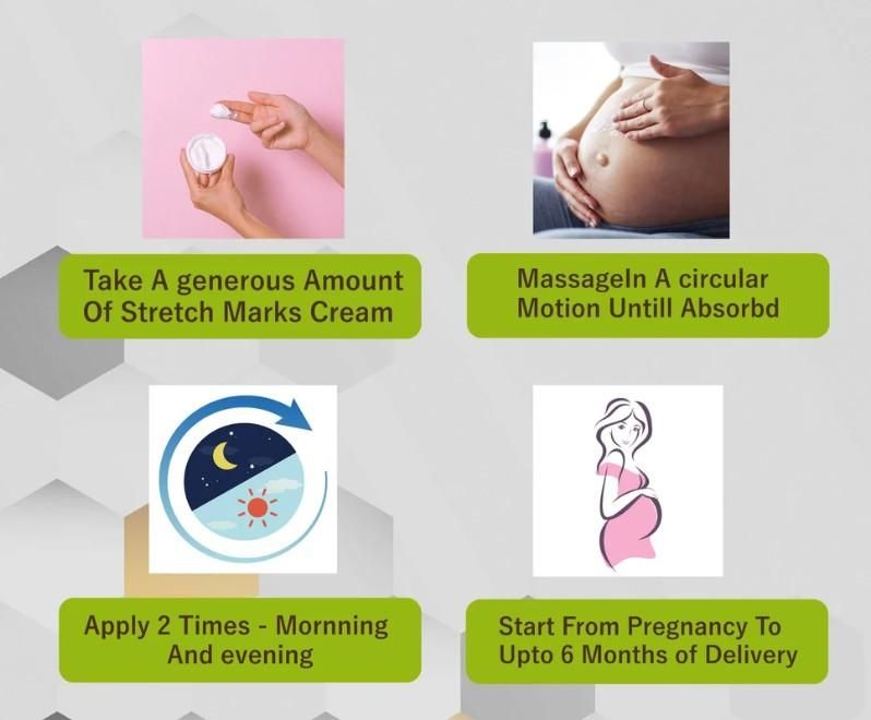 Stretch Mark (Pack of 2)